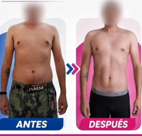 Antes y después de recomposición corporal masculina