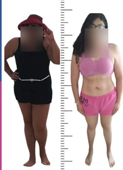 Antes y después de recomposición corporal con rostro difuminado